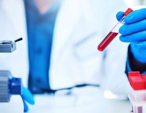 iStock-1135384947-blood-vial-WEB-888x500